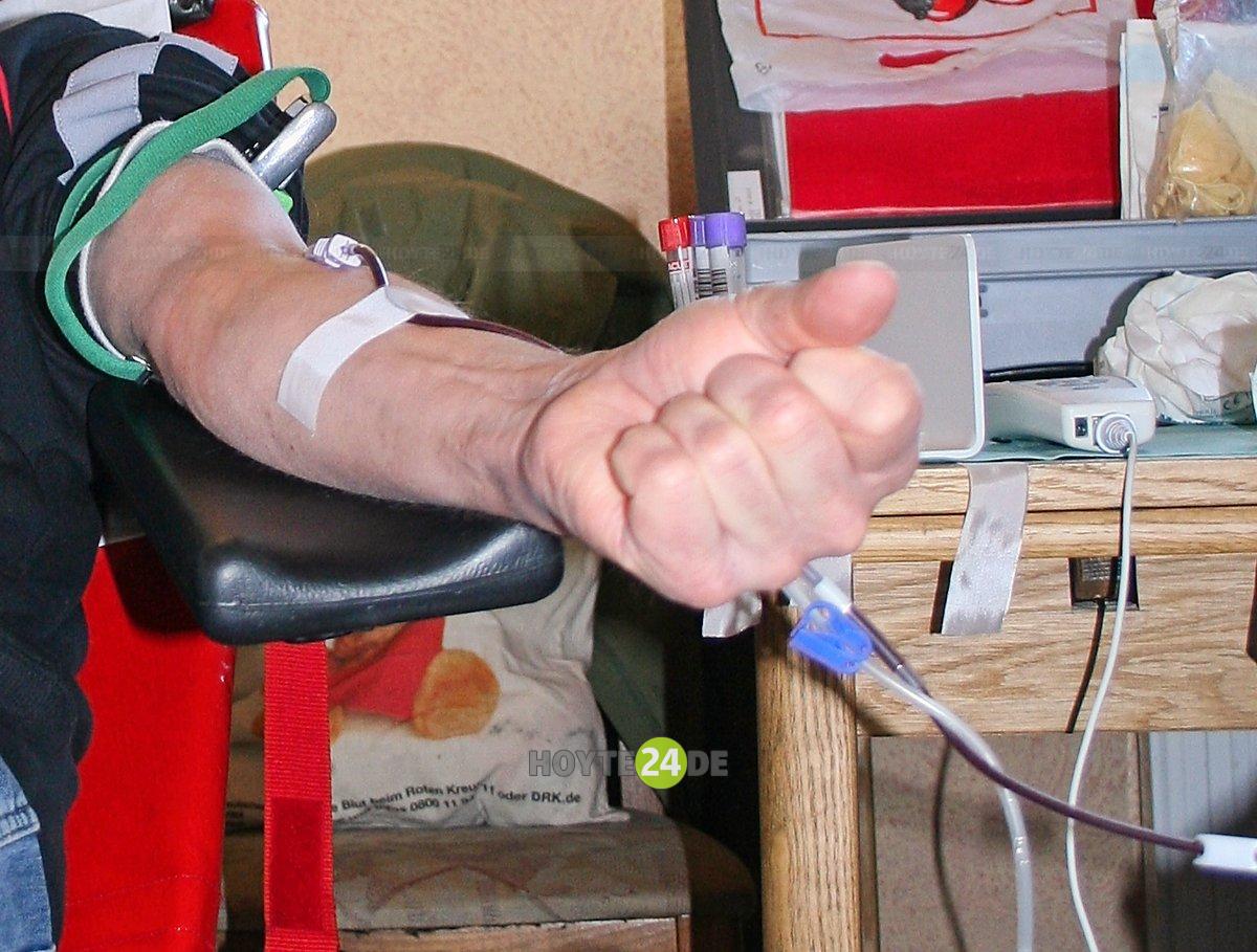 Man sieht einen Arm mit Nadel und Schlauch.